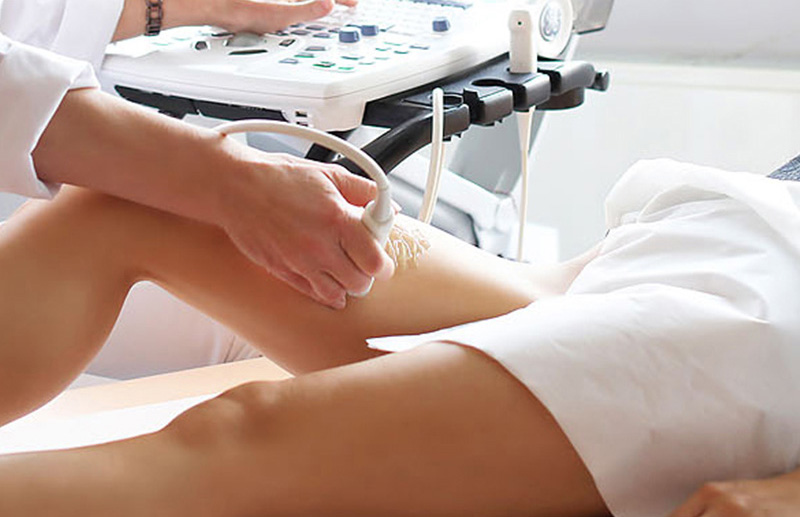 ecodoppler ultrassom vascular de membros