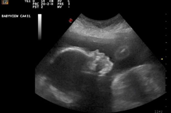 Nene perfil 27.12.12