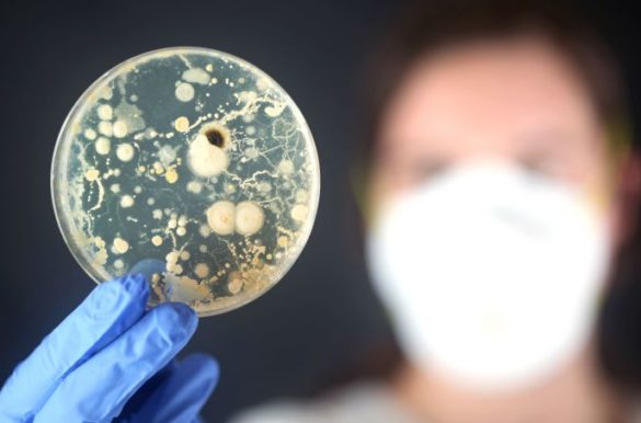 antrax bacteria russia 0816 1400x800