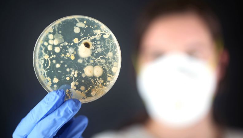 antrax bacteria russia 0816