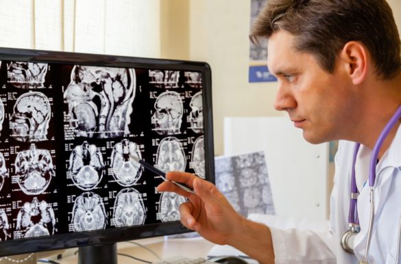 neurologia